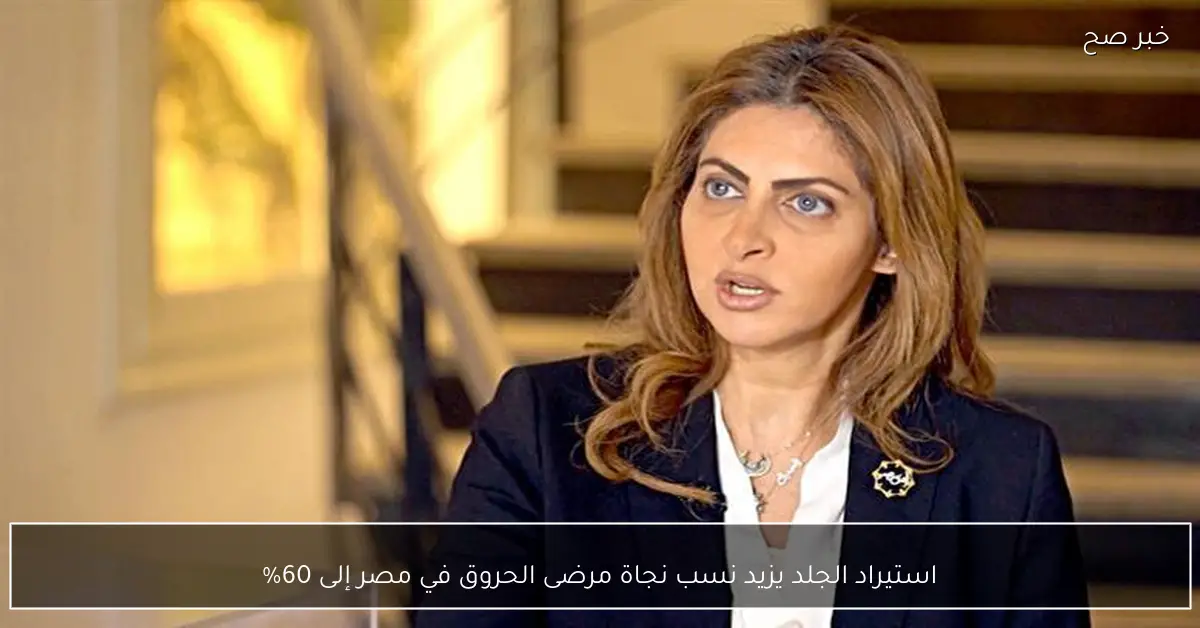 استيراد الجلد يزيد نسب نجاة مرضى الحروق في مصر إلى 60%