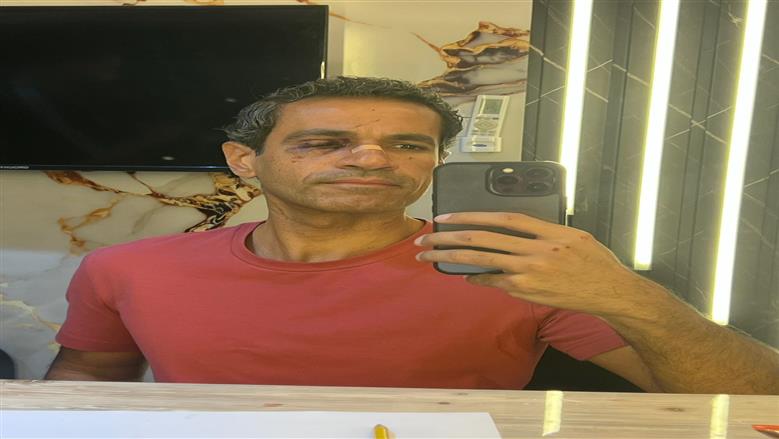 لا ترد ولا تستبدل