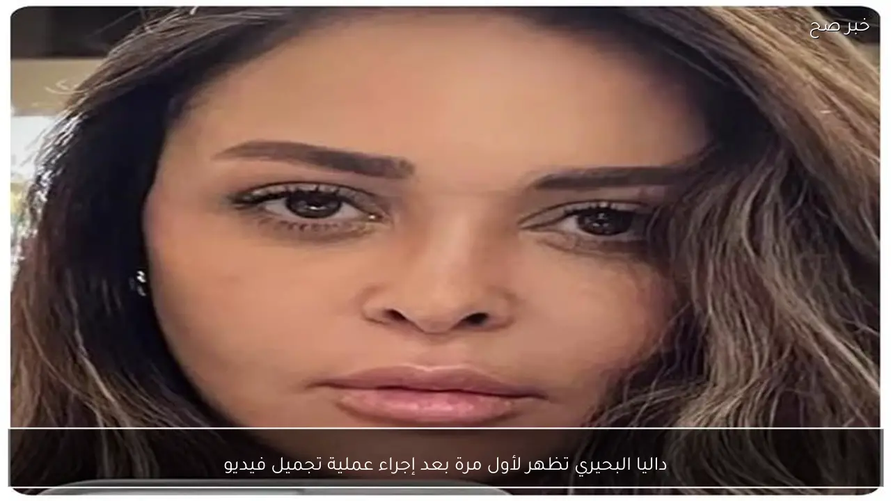 داليا البحيري تظهر لأول مرة بعد إجراء عملية تجميل فيديو