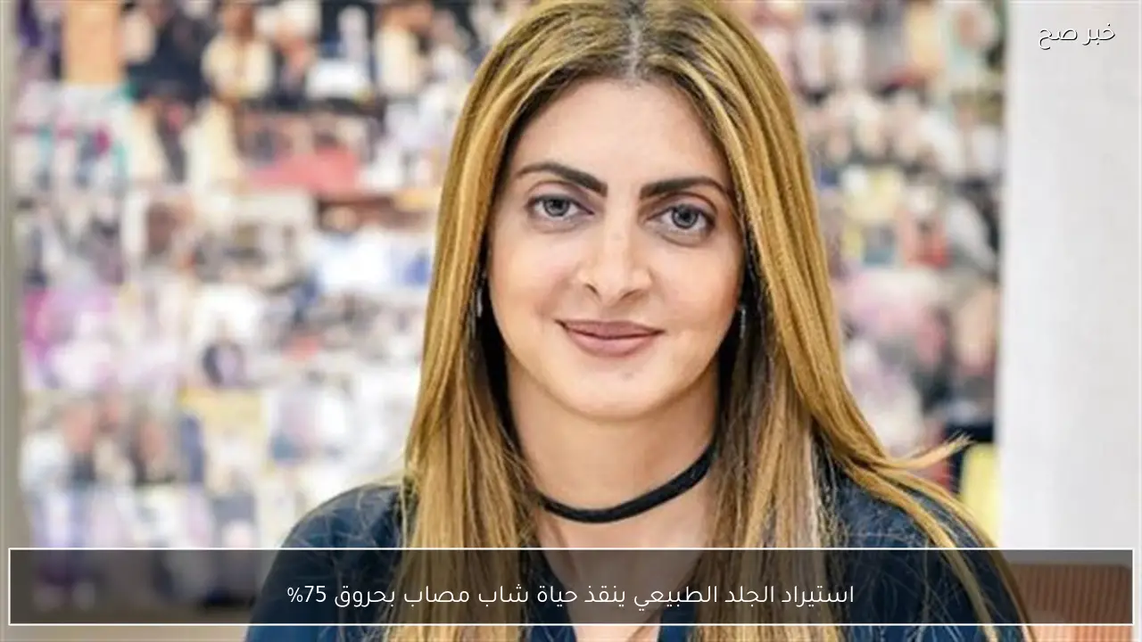 استيراد الجلد الطبيعي ينقذ حياة شاب مصاب بحروق 75%