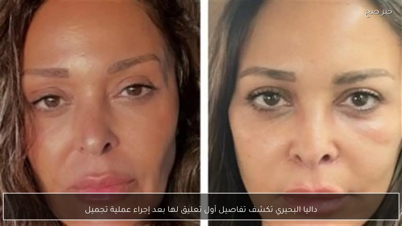 داليا البحيري تكشف تفاصيل أول تعليق لها بعد إجراء عملية تجميل